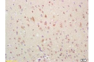 Formalin-fixed and paraffin embedded rat brain labeled with Anti-GADD45 Polyclonal Antibody, Unconjugated (ABIN685432) followed by conjugation to the secondary antibody and DAB staining (GADD45A antibody  (AA 65-165))