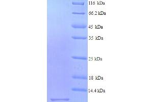 SDS-PAGE (SDS) image for Stimulator of Chondrogenesis 1 (SCRG1) (AA 21-98) protein (His tag) (ABIN4974927)