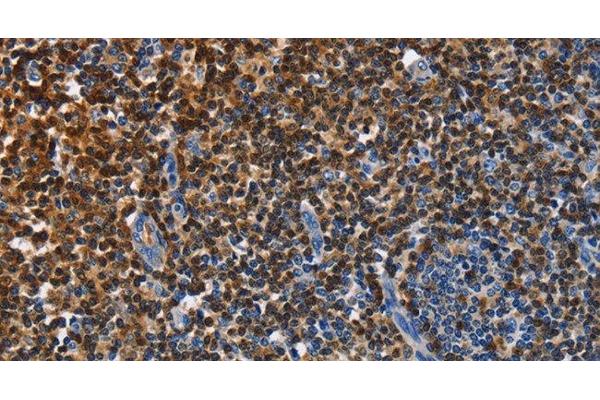 ENPP5 antibody