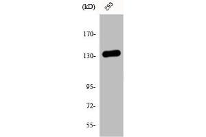 Western Blot analysis of 293 cells using DGK-ι Polyclonal Antibody (DGKI antibody  (C-Term))