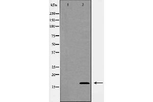Western blot analysis of COX IV expression in Jurkat cells. (COX IV antibody  (Internal Region))