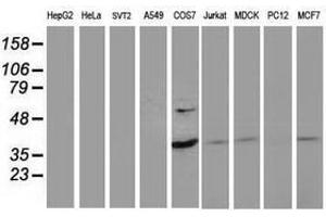 Image no. 2 for anti-PDZ and LIM Domain 2 (PDLIM2) antibody (ABIN1500128) (PDLIM2 antibody)