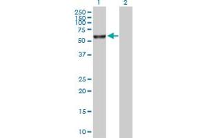 Western Blot analysis of FANCE expression in transfected 293T cell line by FANCE MaxPab polyclonal antibody.