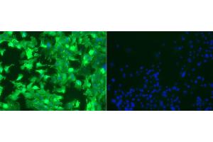 Immunofluorescence staining of 4T1 cell line  The mouse breast cancer cell line 4T1, fixed with formaldehyde, was stained with  (left panel) and staining visualized using a Alexa488- conjugated donkey anti-mouse IgG (H+L).