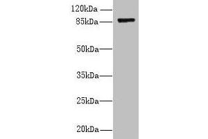 Western blot All lanes: FSCB antibody at 1.
