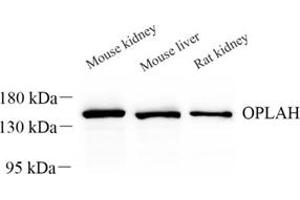 Western blot analysis of OPLAH (ABIN7072860) at dilution of 1: 500