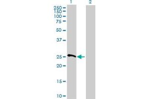 Western Blot analysis of MRPS10 expression in transfected 293T cell line by MRPS10 MaxPab polyclonal antibody.