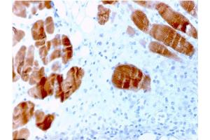 Formalin-fixed, paraffin-embedded human Skeletal Muscle stained with Sarcomeric Actinin Alpha 2 Mouse Monoclonal Antibody (ACTN2/3291).