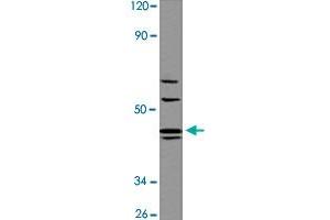 Western blot analysis of A-549 cell lysate with AGTR1 polyclonal antibody  at 1:500 dilution. (Angiotensin II Type-1 Receptor antibody  (AA 150-200))