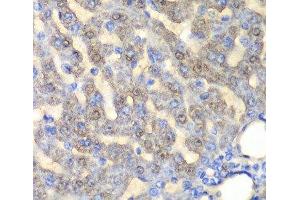 Immunohistochemistry of paraffin-embedded Rat liver using FAH Polyclonal Antibody at dilution of 1:100 (40x lens). (FAH antibody)