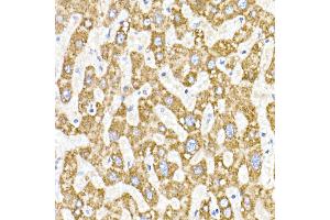 Immunohistochemistry of paraffin-embedded human liver using  Rabbit mAb (ABIN7265363) at dilution of 1:25 (40x lens). (ACAT1 antibody)