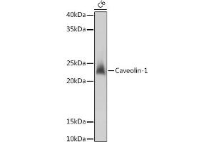 Western blot analysis of extracts of C6 cells, using Caveolin-1 antibody (ABIN6131271, ABIN6137992, ABIN6137993 and ABIN6218615) at 1:1000 dilution. (Caveolin-1 antibody  (AA 1-100))
