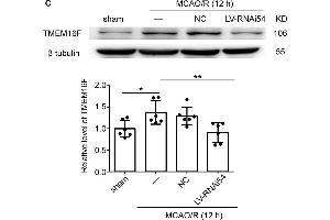 LV-TMEM16F-RNAi transfection downregulates TMEM16F in rat brain. (Anoctamin 6 antibody  (AA 744-824))