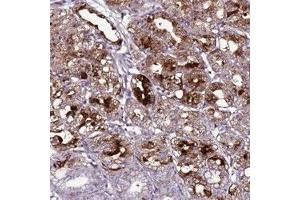 Immunohistochemical staining of human stomach, lower with C19orf47 polyclonal antibody  shows strong cytoplasmic positivity in glandular cells at 1:50-1:200 dilution.