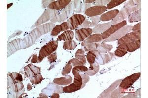 Immunohistochemistry (IHC) analysis of paraffin-embedded Human Muscle, antibody was diluted at 1:100. (ATP2A2 antibody  (C-Term))