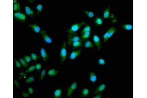 Immunofluorescence staining of Hela cells with ABIN7172247 at 1:333, counter-stained with DAPI. (TRAF6 antibody  (AA 1-522))