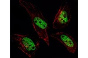 Fluorescent image of HeLa cells stained with SUMO antibody at 1:25.