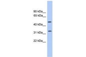 Image no. 1 for anti-Tumor Protein P63 Regulated 1 (TPRG1) (C-Term) antibody (ABIN6746427) (TPRG1 antibody  (C-Term))
