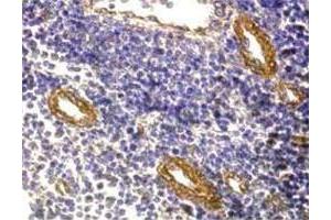 Immunohistochemistry (Formalin/PFA-fixed paraffin-embedded sections) analysis in human tonsil with FOXP3 polyclonal antibody  at 5 ug/mL. (FOXP3 antibody  (C-Term))