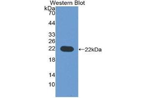 Western Blotting (WB) image for anti-CD276 (CD276) (AA 47-219) antibody (ABIN1867121) (CD276 antibody  (AA 47-219))