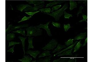 Immunofluorescence of monoclonal antibody to PML on HeLa cell. (PML antibody  (AA 411-510))