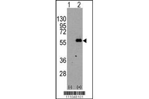 Western blot analysis of MEF2C using rabbit polyclonal MEF2C Antibody (S396) using 293 cell lysates (2 ug/lane) either nontransfected (Lane 1) or transiently transfected with the MEF2C gene (Lane 2). (MEF2C antibody  (AA 374-403))