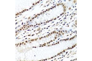 Immunohistochemistry of paraffin-embedded human stomach using METTL3 antibody (ABIN5974672) at dilution of 1/100 (40x lens). (METTL3 antibody)