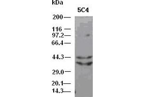 DFF45 antibody (5C4) at 1:5000 dilution + Hela cell lysate (DFFA antibody)