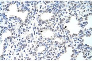 Immunohistochemical staining (Formalin-fixed paraffin-embedded sections) of human intestine with MCM6 polyclonal antibody . (MCM6 antibody  (AA 771-820))