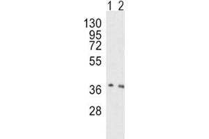 Western blot analysis of OGG1 antibody and human HeLa (lane 1), mouse NIH3T3 (2) lysate (OGG1 antibody  (AA 318-345))