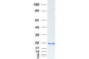 Validation with Western Blot (SAR1B Protein (Transcript Variant 2) (Myc-DYKDDDDK Tag))