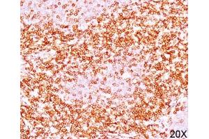 IHC testing of human tonsil (10X) stained with CD6 antibody (C6/372). (CD6 antibody)
