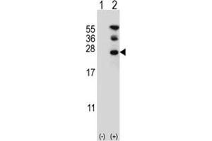 Western blot analysis of RAN antibody and 293 cell lysate either nontransfected (Lane 1) or transiently transfected (2) with the RAN gene. (RAN antibody  (AA 12-39))