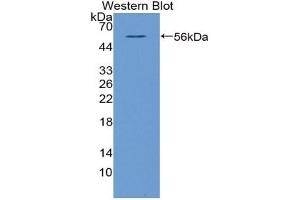 Detection of Recombinant NT5E, Bovine using Polyclonal Antibody to Cluster Of Differentiation 73 (CD73) (CD73 antibody  (AA 48-527))