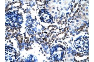 Human kidney (BAX antibody  (N-Term))