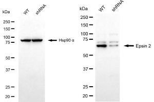 anti-Epsin 2 (EPN2) antibody
