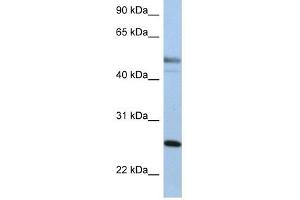 Cytokeratin 8 antibody used at 1 ug/ml to detect target protein. (KRT8 antibody  (Middle Region))