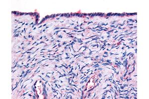 Anti-THRA antibody IHC of human surface epithelium. (THRA antibody  (Ligand Binding Domain))