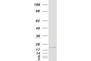 Validation with Western Blot (TWIST2 Protein (Myc-DYKDDDDK Tag))