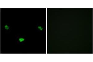 Immunofluorescence analysis of LOVO cells, using HNF4 alpha (Phospho-Ser313) Antibody. (HNF4A antibody  (pSer313))