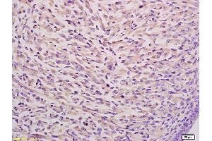 Formalin-fixed and paraffin embedded mouse embryo tissue labeled with Anti CKAP4 Polyclonal Antibody,Unconjugated (ABIN717506) at 1:200 followed by conjugation to the secondary antibody and DAB staining. (CKAP4 antibody  (AA 525-602))