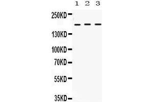 Western Blotting (WB) image for anti-Leukemia Inhibitory Factor Receptor alpha (LIFR) (AA 863-899), (C-Term) antibody (ABIN3043410)