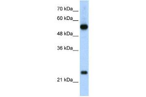 WB Suggested Anti-RPL13  Antibody Titration: 2. (RPL13 antibody  (C-Term))