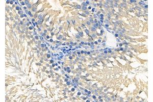 ABIN6264759 and ABIN6278629 at 1/100 staining Rat testis tissue by IHC-P. (RIOK3 antibody  (Internal Region))