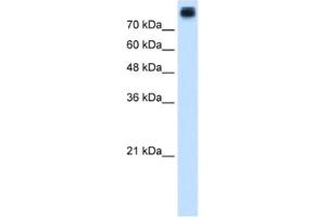 Western Blotting (WB) image for anti-P-Cadherin (CDH3) antibody (ABIN2462833) (P-Cadherin antibody)