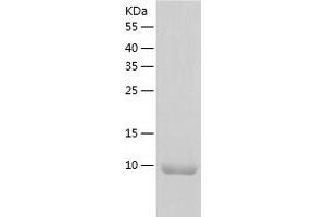 Western Blotting (WB) image for Eukaryotic Translation Initiation Factor 1 (EIF1) (AA 1-113) protein (His tag) (ABIN7122833) (EIF1 Protein (AA 1-113) (His tag))