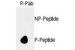 Dot blot analysis of anti-hRb- Phospho-specific Pab (ABIN389645 and ABIN2839637) on nitrocellulose membrane. (Retinoblastoma 1 antibody  (pSer788))
