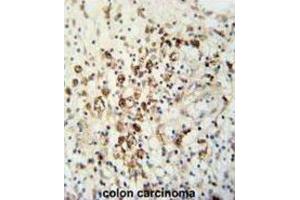 Immunohistochemistry (IHC) image for anti-HAUS Augmin-Like Complex, Subunit 5 (HAUS5) antibody (ABIN3002272) (HAUS5 antibody)