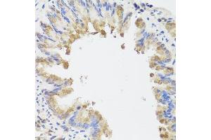Immunohistochemistry of paraffin-embedded mouse lung using AMBRA1 antibody. (AMBRA1 antibody  (AA 1109-1208))