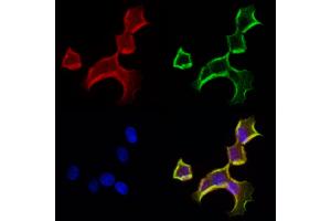ABIN6262995 and ABIN6272963 staining Hela cells by IF/ICC. (LONP1 antibody  (C-Term))